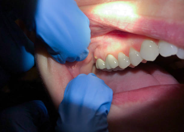 Best Emergency TMJ Treatment in Flying Hills, PA