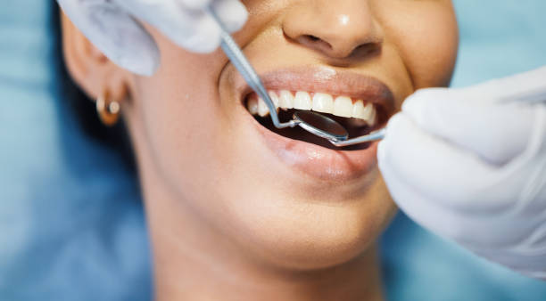 Best Emergency Treatment for Dental Infections or Abscesses in Flying Hills, PA